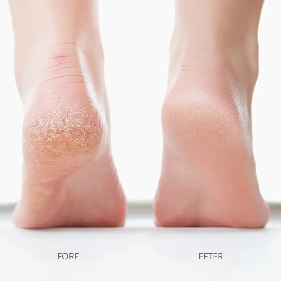 SlimSkin Pro V2 - För mjukare fötter