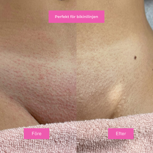 Hårborttagningsolja - Naturligt len hud utan rakhyvel