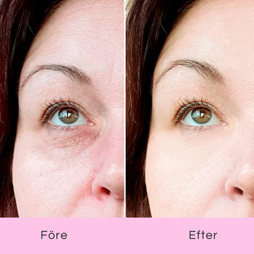 K-Beauty Eye Pads – Piggare ögon på 10 minuter