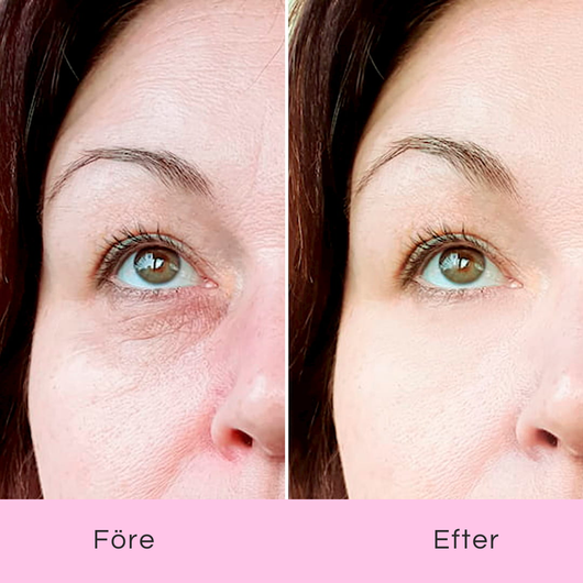 K-Beauty Eye Pads – Piggare ögon på 10 minuter